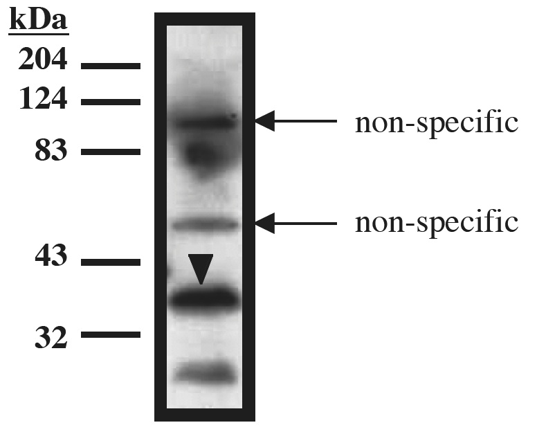 "
Western blot analysis using TUP1 antibody on recombinant TUP1 protein (amino acids 1-200) expressed in Mav108 cells."